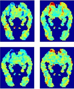 NSF-fMRI-quad-image-251x300